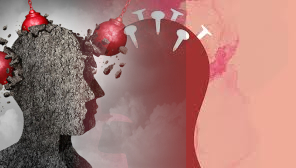 How to Manage Headache